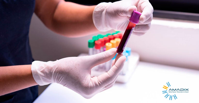 A blood-based test that can detect cancer before its symptoms appear